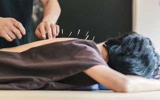 Image for Acupuncture May Help Stress, Anxiety and Insomnia Well