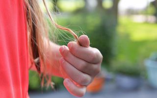 Image for Hair Loss Basics: Causes, Types & Symptoms