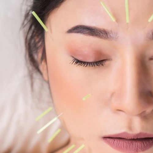 Can Acupuncture Help with Sleep Disorders? | NaturalTherapyPages.com.au