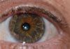 Kwinana Naturopath - Iridology