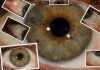 VMK Naturopath - Iridology & Sclerosis