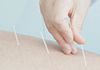 Adelaide Integrative Acupuncture