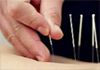 YUE XIU HUI Chinese Herbal Clinic - Acupuncture