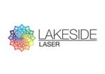 Lakeside Laser
