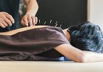 Dry Needling & Myofascial Decompression (Cupping)