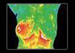 Welcome to THERMO-MED AUSTRALIA
