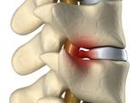 Chiropractic Ringwood