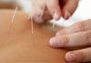 Solaris Health & Harmony Centre - Acupunture