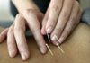 Narture - Acupuncture