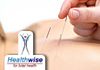 Healthwise - Acupuncture