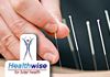 Healthwise- Dry Needling