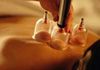Evergreen Health Harmony Lifestyle - Ear Candling & Cupping