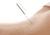 The Nature Of Balance - Acupuncture