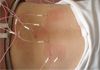 Ringwood Modern Acupuncture & Chinese Medicine Clinic - Acupuncture & Chinese Herbal Medicine