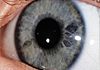 Iridology