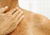 Suzannegoldbery - Lymphatic Drainage