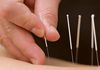 Stay Tuned Sports Medicine - Acupuncture & Chinese Medicine