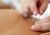 The Weston Acupuncture & Naturopathic Clinic - Acupuncture
