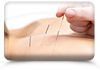 Healthwise  - Massage & Acupuncture