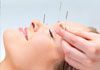 Yan Acupuncture Clinic - Acupuncture