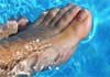 The Foot Group - Sports Injury Therapy