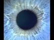 Iridology- What does your eye reveal about your health?