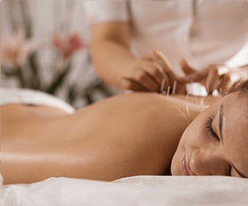Dry needling