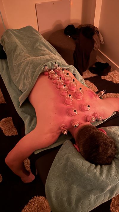 Remedial Massage- Cupping