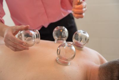 Fire Cupping