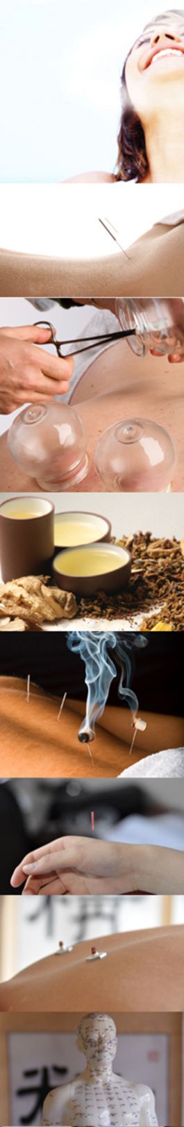 Acupuncture Chinese Medicine Clinics Coburg and Ringwood